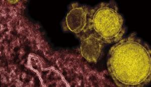 [전문가분석]  신종 코로나바이러스란 무엇인가?